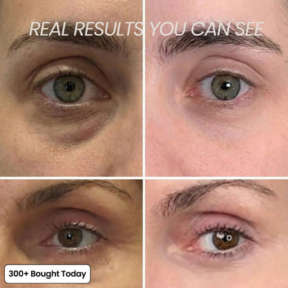 VitaLift™ Revival Balm